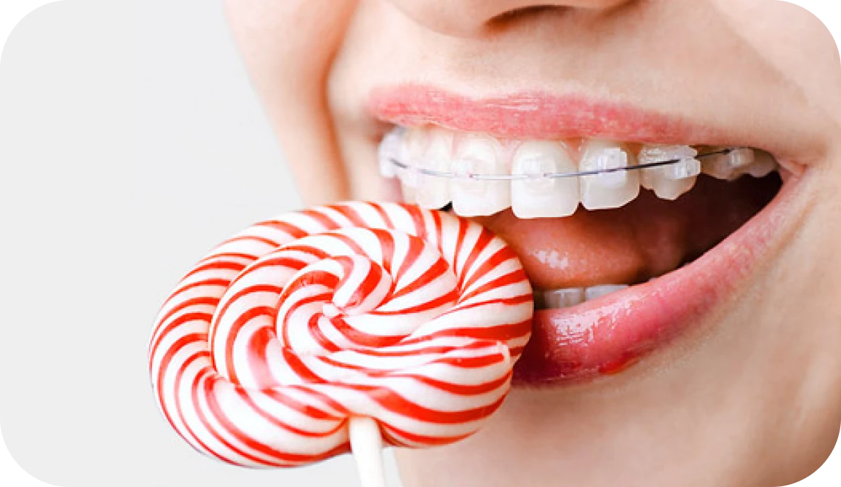 Alimentation et appareils orthodontiques