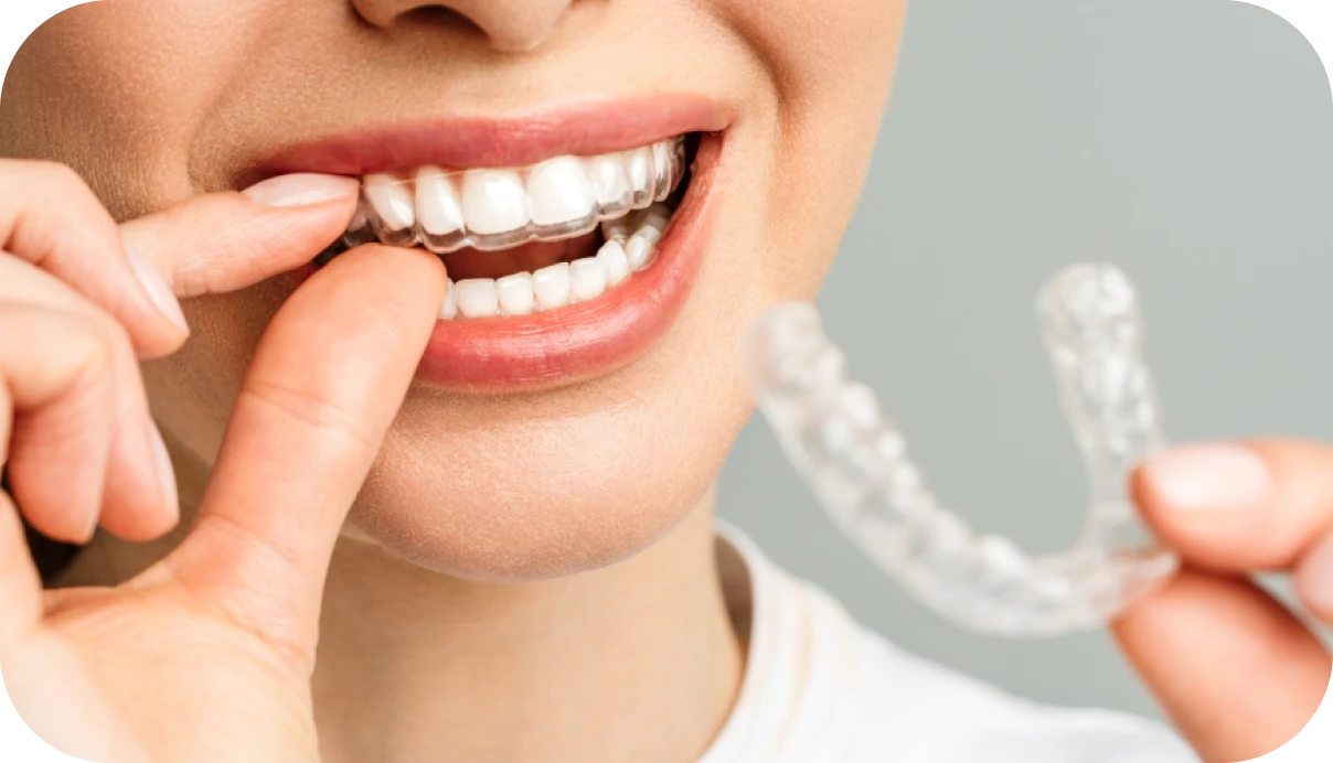 Entretien des appareils orthodontiques